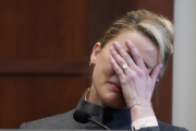 Did Amber Heard Accidentally Reveal In Court That She Used A Fake Bruise Kit?