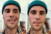 Justin Bieber shares health update after revealing his face is partially paralysed: ‘This storm will pass’