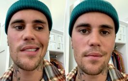 Justin Bieber shares health update after revealing his face is partially paralysed: ‘This storm will pass’